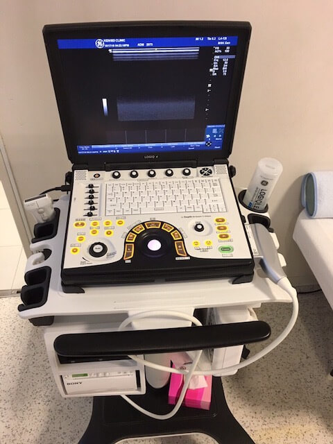 汎用超音波画像診断装置（LOGIQ e）